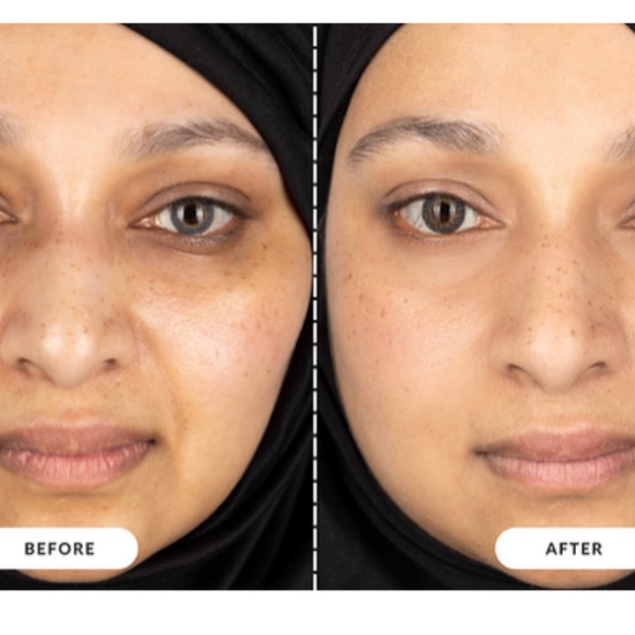 CurrentBODY | Skin L E D Light Therapy Face + Neck Duo Masks - Picture 9 of 16